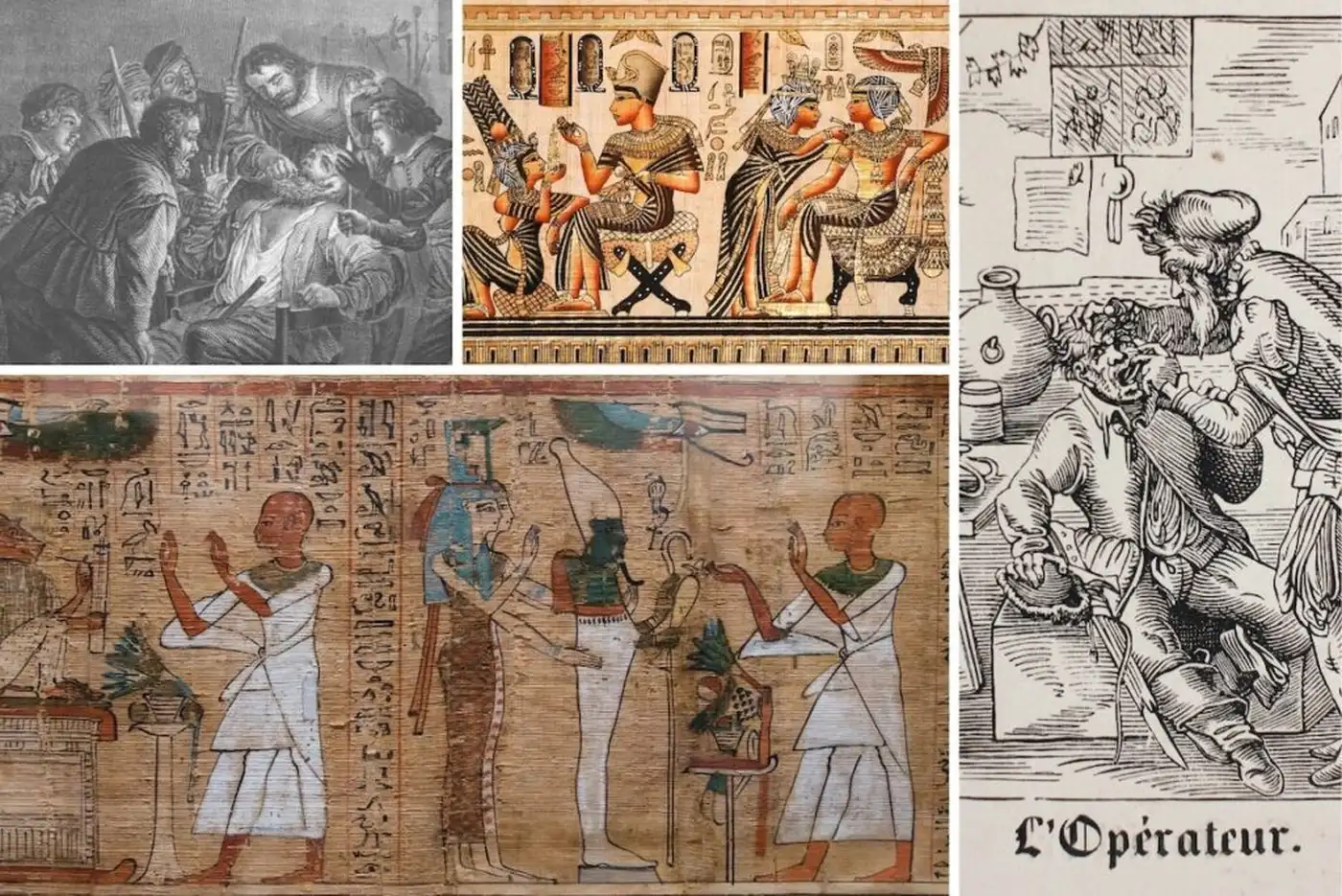 Від древніх зубодерів до цифрових технологій: як розвивалася стоматологія