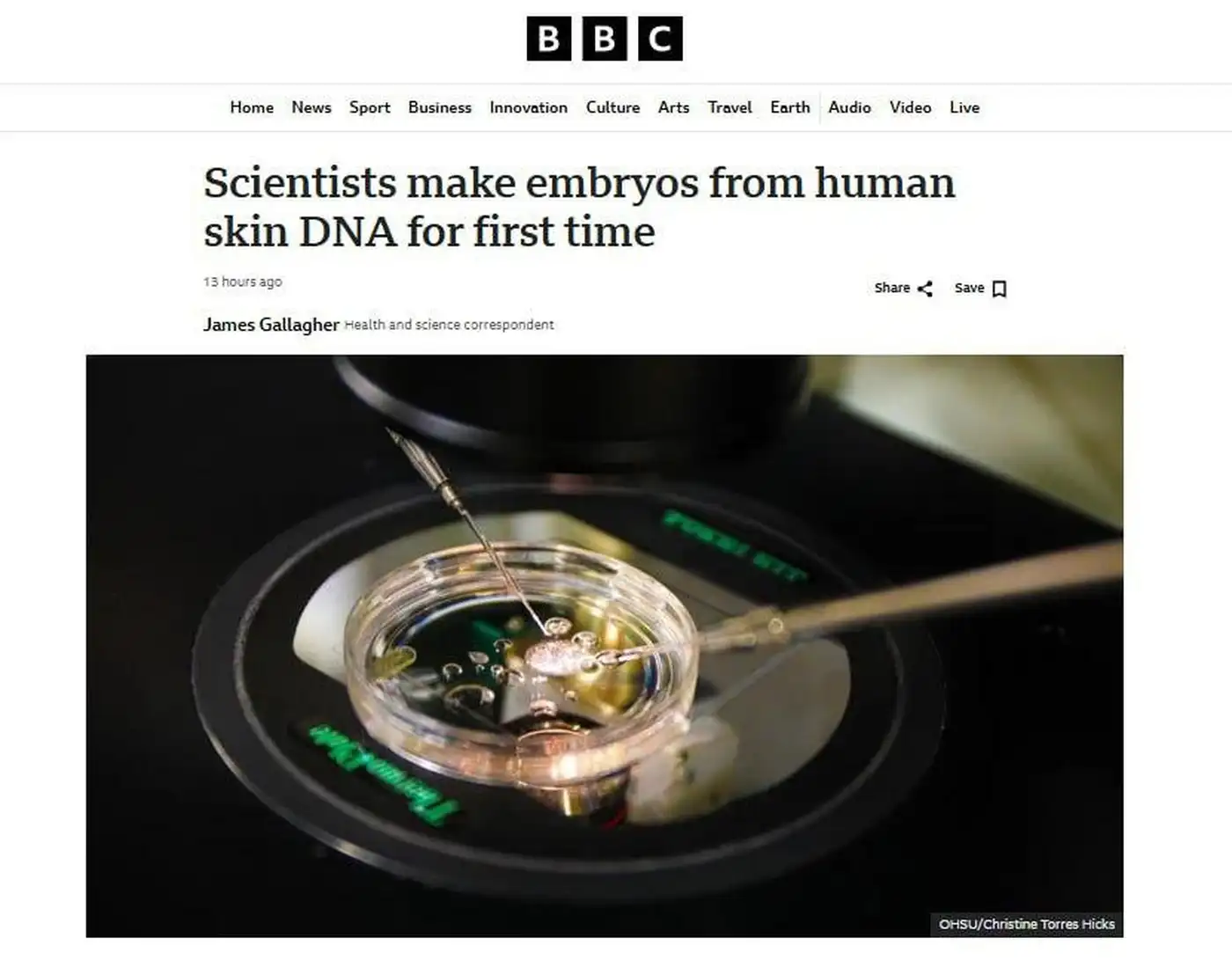 Учёные вырастили первые эмбрионы из ДНК человеческой кожи