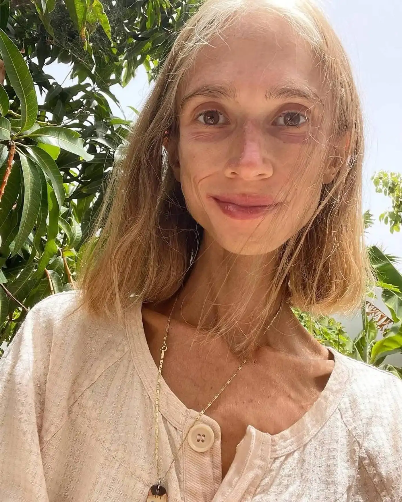 На Бали от истощения умерла полька, питавшаяся только фруктами