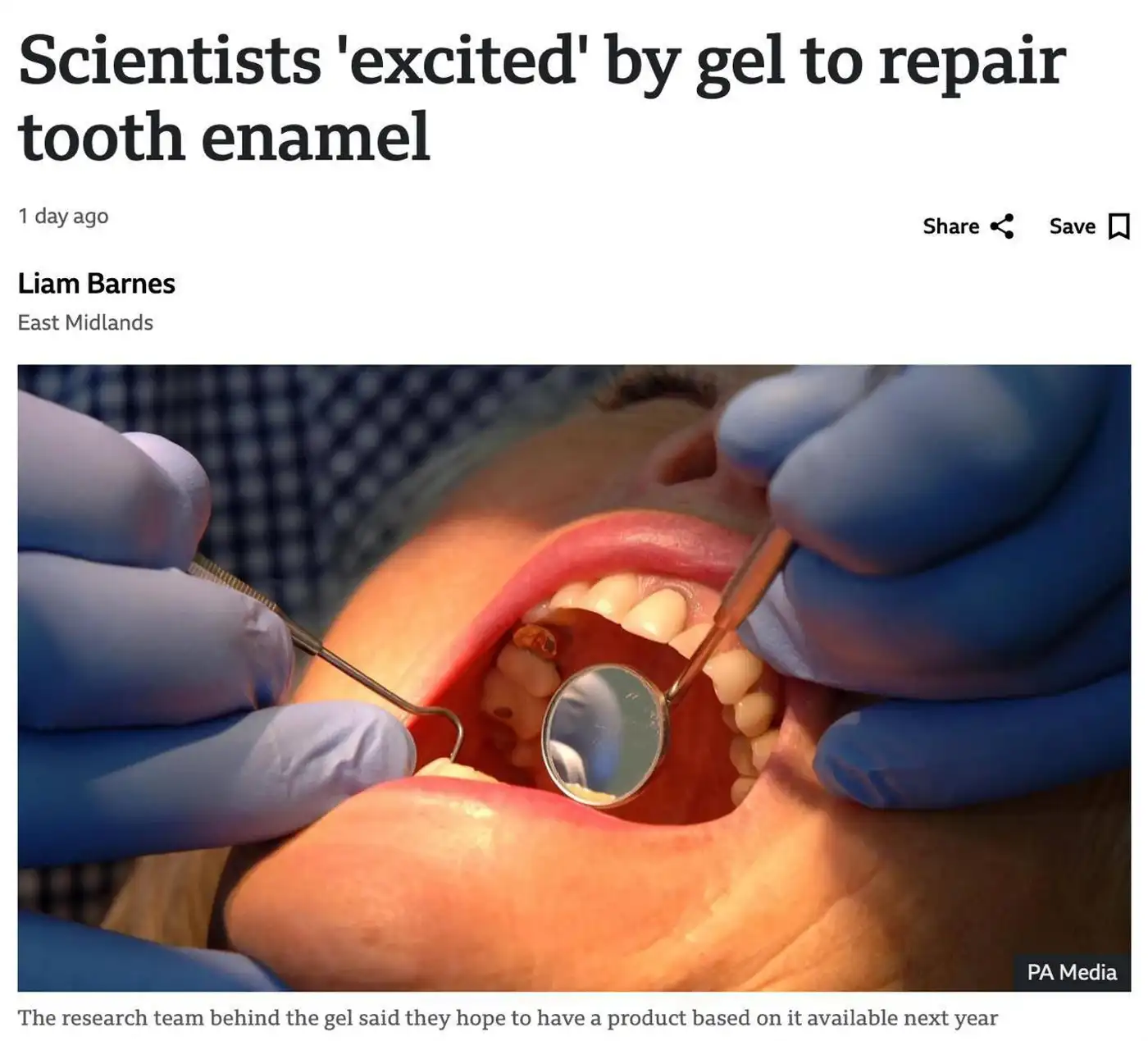Кариес может уйти в прошлое! Учёные создали гель, который восстанавливает зубную эмаль