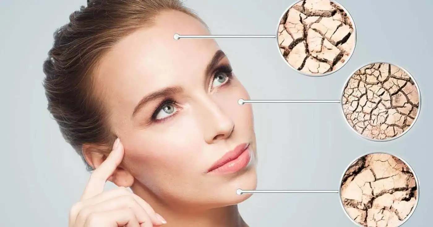 Признаки того, что коже нужна помощь